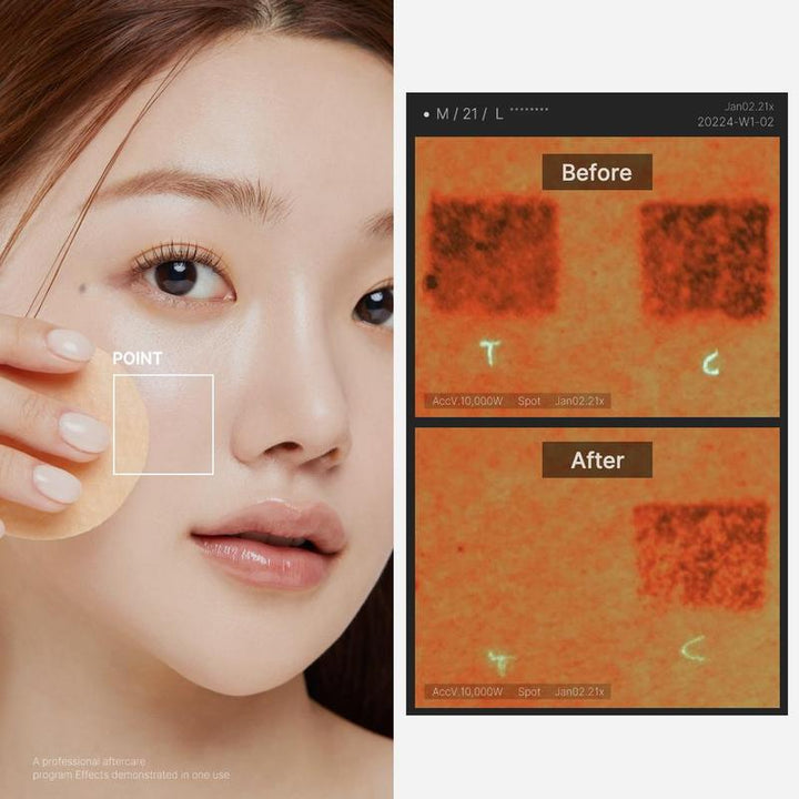 DERMASKIN Acne Clearing Pads