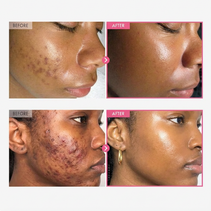 BrightEye Fix Cream