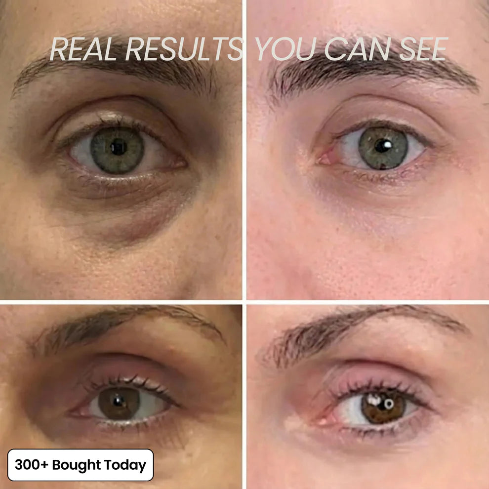 Claremont® Calcium Eye Balm
