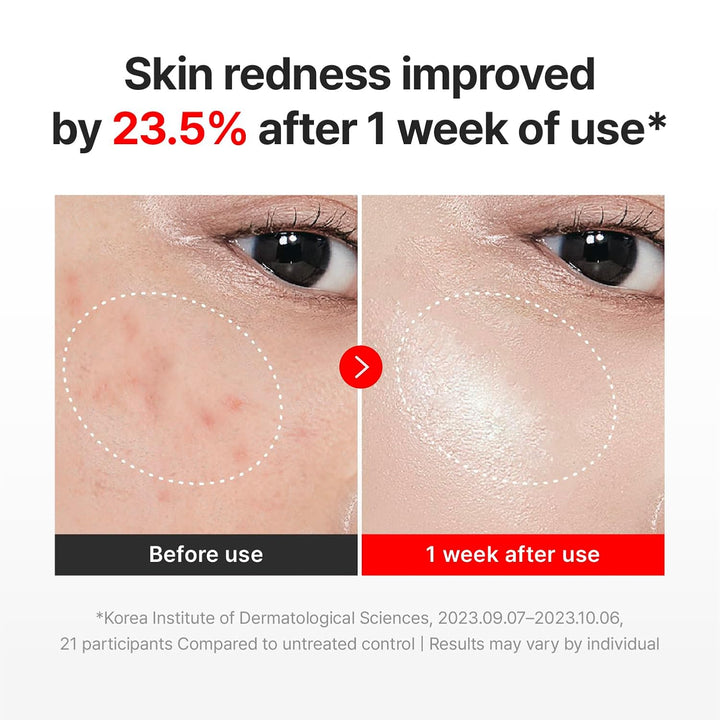 Centella Time Renewal Cream