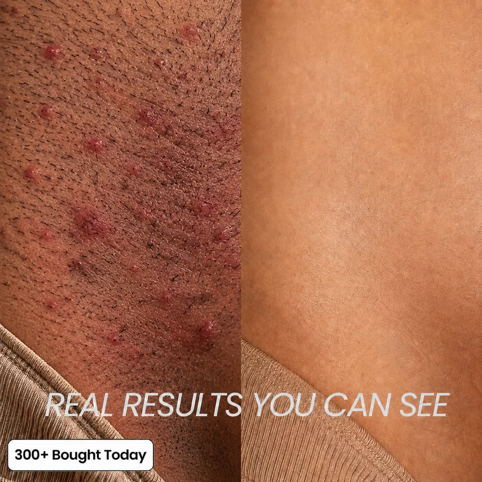 Clare Anti-Hair Growth Oil
