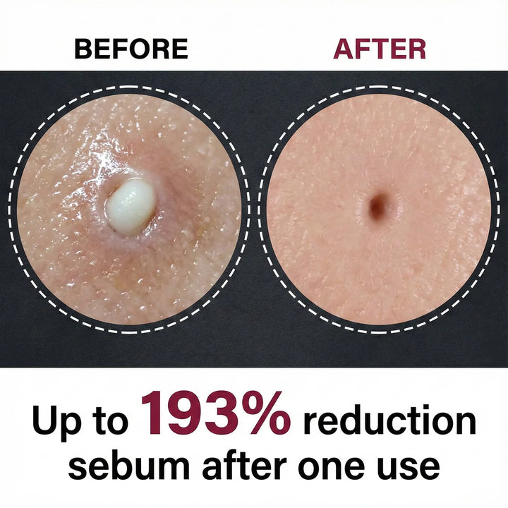 Pure Glow Rice Peel Duo