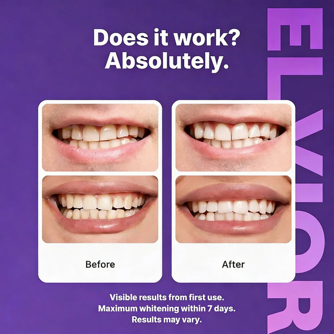 Purple Teeth Whitening Strips