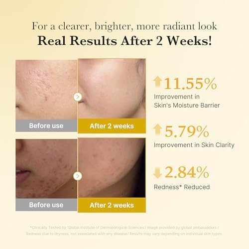Claremont Kojic Acid Renew &amp; Smooth Duo